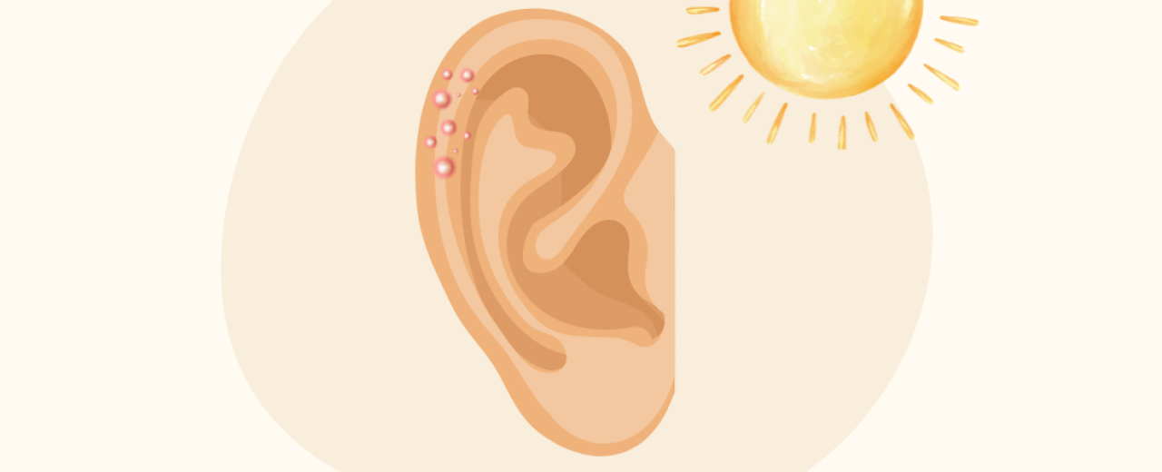 Lente-oren: een voorjaarsreactie op de zon