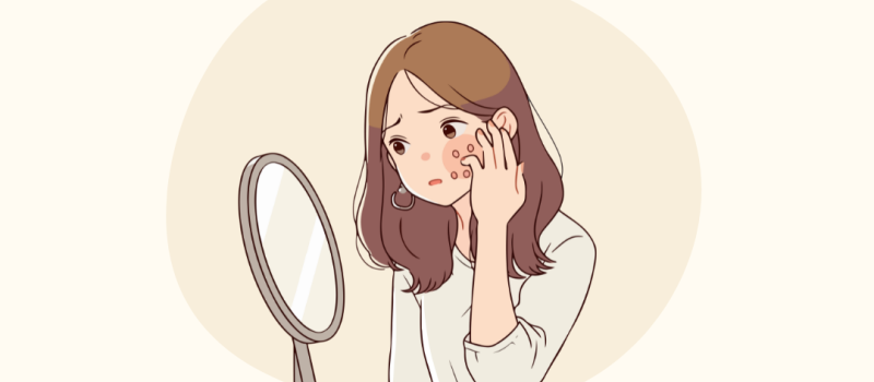 Wat is purging? En waarom lijkt je huid slechter te worden van je nieuwe skincare?